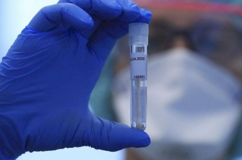 Gürcüstanda son sutkada 298 nəfər COVID-19-a yoluxub