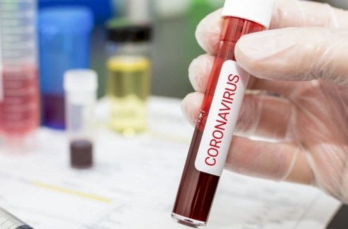 Ermənistanda koronavirusdan ölənlərin sayı 3047 nəfərə çatıb