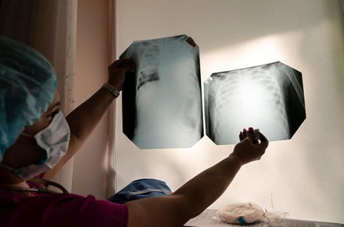 2-3 aydan sonra Azərbaycanda koronavirus yoxa çıxa bilər - Şöbə müdiri AÇIQLADI