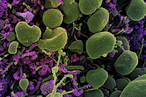 “Britaniya ştammı” da mutasiyaya uğradı