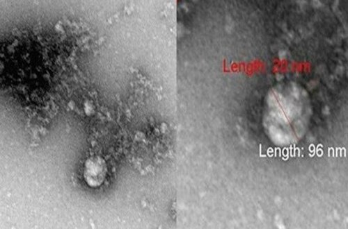 Mutasiyaya uğramış koronavirusun mikroskop altında görüntüsü