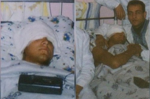 İlham Zəkiyev 12 il öncə ölümcül yaralı olduğu vəziyyətdəki görüntülərini paylaşdı - FOTO