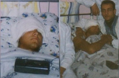 Ильхам Закиев поделился снимками, сделанными 12 лет назад после ранения - ФОТО