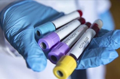 Azərbaycanda koronovirusdan üç nəfər öldü