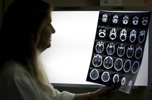 Bu xəstəlik koronavirusdan ölüm riskini artırır