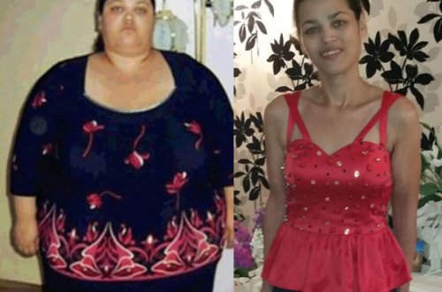 120 kiloqram arıqladı, intihara cəhd etdi - FOTO