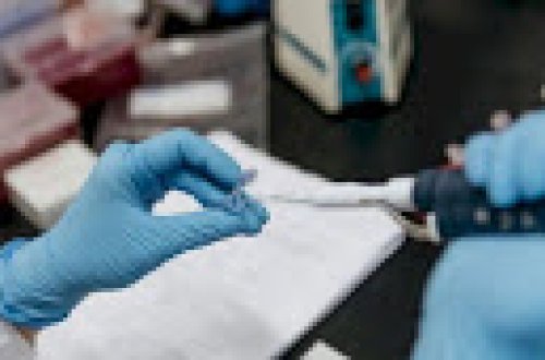 Koronavirusun yeni ştammı Azərbaycanda qeydə alınıbmı?