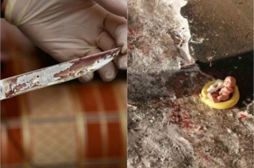 Sərxoş qadın iki yaşlı nəvəsini bıçaqladı - FOTO/VİDEO