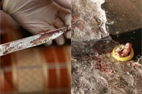 Sərxoş qadın iki yaşlı nəvəsini bıçaqladı - VİDEO