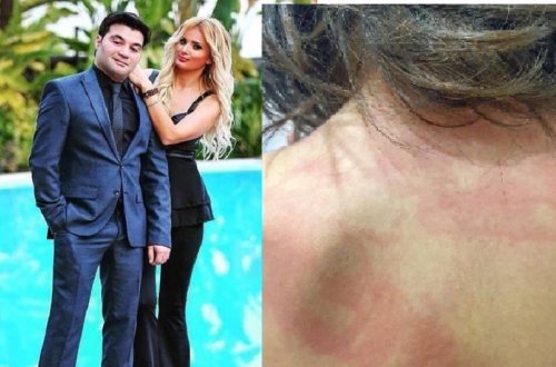 Əməkdar artistin gəlini qızının işgəncəyə məruz qaldığını iddia edir - FOTO