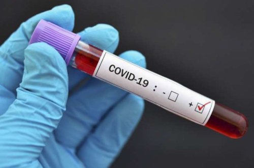 Rusiyada son sutkada 502 nəfər koronavirusdan ölüb