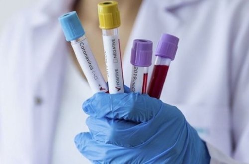 Ermənistanda koronavirusdan ölənlərin sayı 3141-ə çatıb