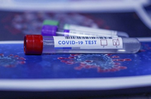Azərbaycanda indiyədək 2 506 005 koronavirus testi aparılıb