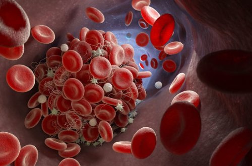 Koronavirusdan ölənlərin beyin kapillyarlarında qan laxtaları müəyyən olunub