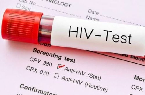 ARV-terapiyanın İİV-ə yoluxmuş insanlara təsiri ilə bağlı AÇIQLAMA