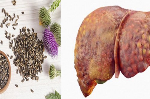 Azərbaycanda 53 yaşlı kişi Hepatit B virusundan bu bitki ilə sağaldı – Möcüzə pasiyent hekayəsi