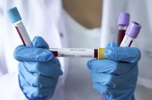 Türkiyədə son koronavirus statistikası açıqlandı – FOTO
