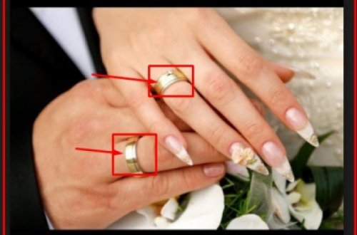 Nişan üzüyünüzü dərhal çıxarın.. - Alimlərdən xəbərdarlıq!