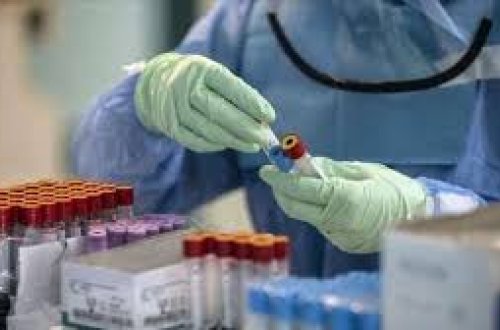 Azərbaycanda koronavirusa yoluxanların sayı yenidən artdı - FOTO