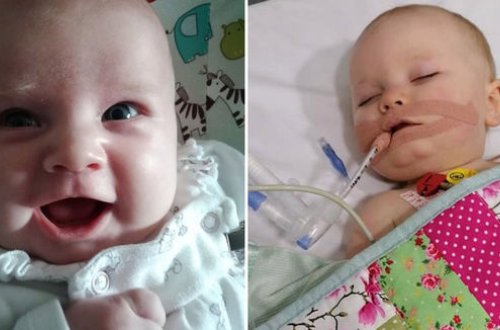 Adi öpüş bir yaşlı uşağı ölümlə üz-üzə qoydu - FOTO