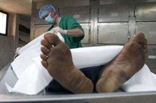 Morqda qorxulu anlar - Meyiti yarmaq istədilər, dirildi