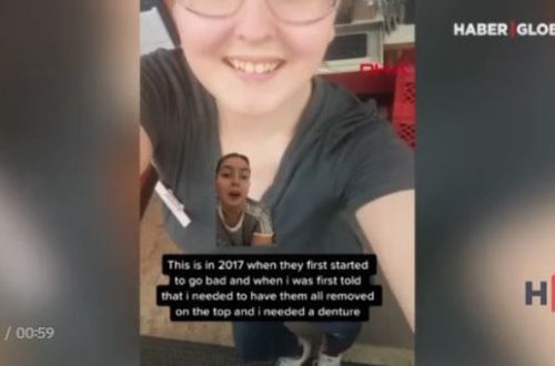 Qazlı içkilər səbəbindən dişlərini itirdi – VİDEO