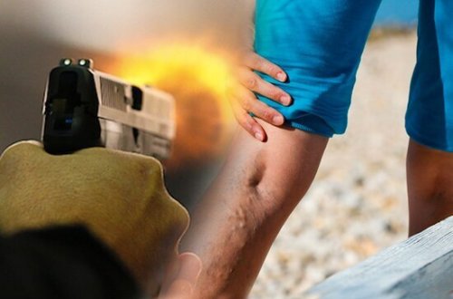 30 yaşlı evli kişi sevgilisinin sifarişi ilə SİLAHLA VURULDU - FOTOLAR