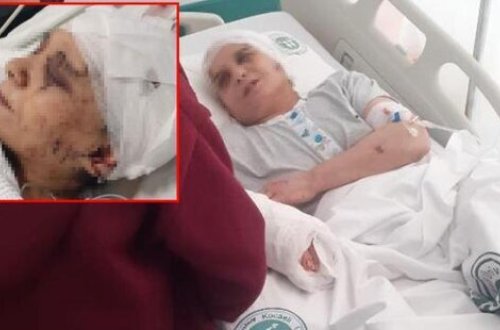 Kişi BALTA İLƏ arvadının başını, barmağını və qulağını KƏSDİ - ŞOK SƏBƏB - FOTO