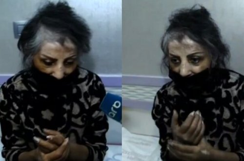 Səhhəti pisləşən Zöhrə Abdullayevanın son durumu - FOTOLAR