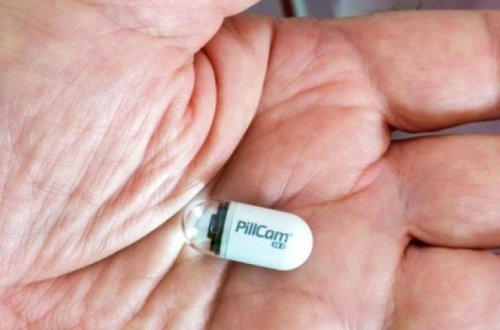 В Британии испытывают капсулы с камерой для ранней диагностики рака кишечника