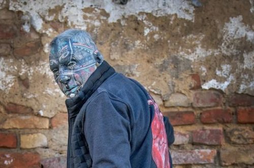 Bədəninin 98 faizi döymə olan təqaüdçü – FOTO