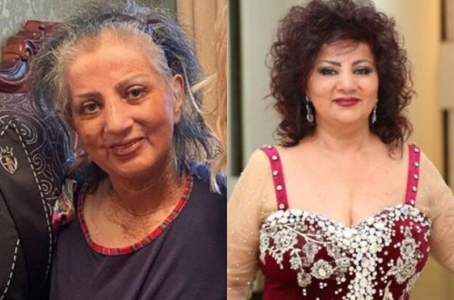 Zöhrə Abdullayeva xəstəxanaya yerləşdirildi - FOTOLAR