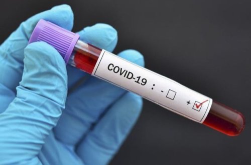 Обнародована последняя мировая статистика по коронавирусу