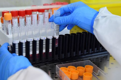 Koronavirusun “Cənubi Afrika” ştammı Rusiyaya çatdı