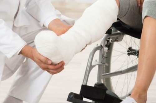 Ayağı qırıldığı üçün xəstəxanaya gedən qadın əslində kişi olduğunu öyrəndi - FOTO