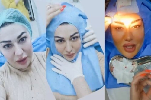 Rəqqasə Fatimə əməliyyat olundu - Görüntülərini paylaşdı + Video