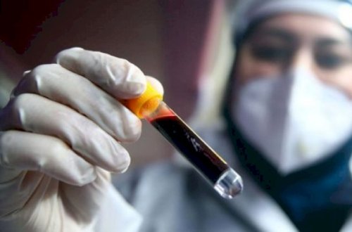 Gürcüstanda 7 nəfər koronavirusdan öldü