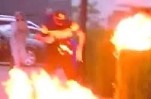 Doğma anası səkkiz yaşlı oğlunu diri-diri yandırdı - FOTO