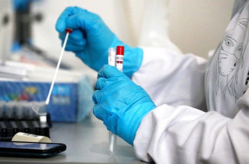 В Азербайджане выявлен 