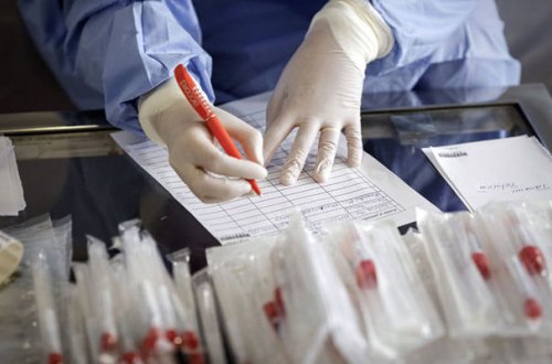 Azərbaycanda yoluxanlar arasında qadınlar çoxluq təşkil edir - RƏSMİ