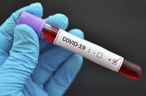 Gürcüstanda son sutkada COVID-19-a 262 yoluxma halı qeydə alınıb, 9 nəfər ölüb