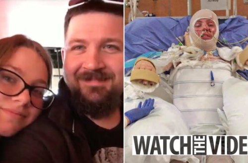 DİRİ-DİRİ yanan 18 yaşlı qızın SON HALI - 18+ FOTOLAR - VİDEO