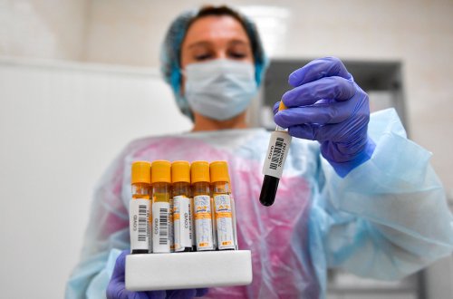 Azərbaycanda koronavirusa yoluxanların sayı AÇIQLANDI