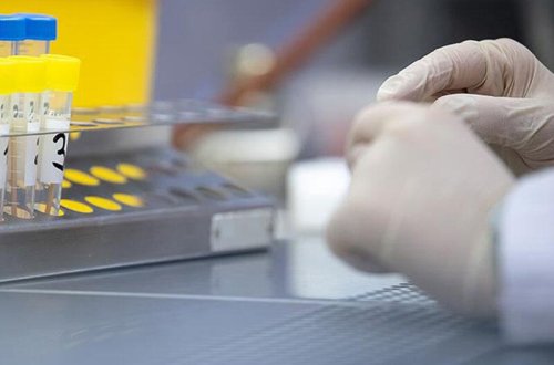 Koronavirusun daha bir ştammı aşkarlandı