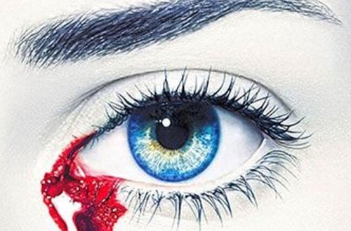 25 yaşlı qız qanlı göz yaşları ilə ağlayır - Unikal hadisə