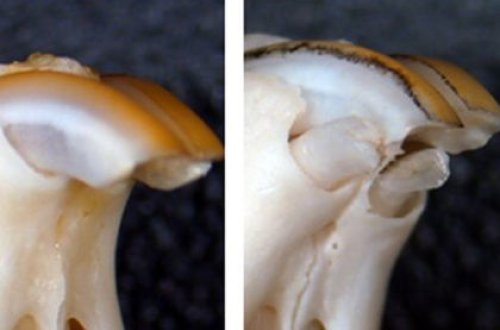 Найден способ вырастить потерянные зубы