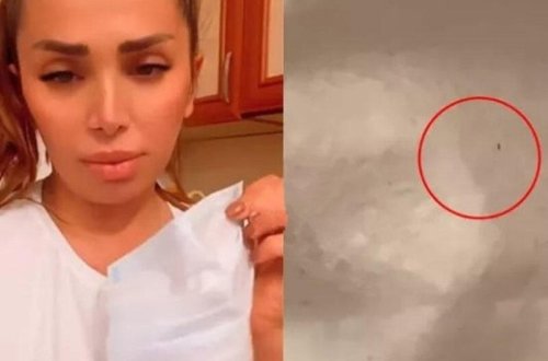 İstifadə etdiyimiz maskalarda qurd var? - VİDEO