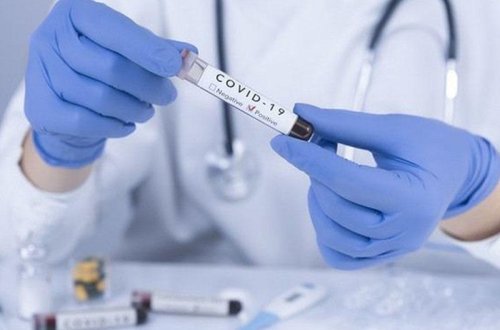 В Азербайджане минувшие сутки стали рекордными в 2021 году по числу летальных исходов от COVID-19 - ФОТО