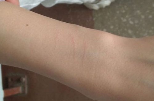 Rusiyada beşinci sinif şagirdləri sosial şəbəkədə videoya baxıb qollarını kəsdilər