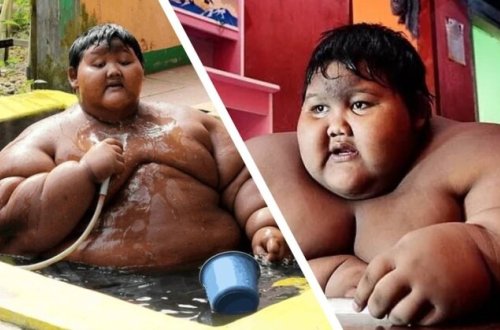 190 kilo çəkisi olan ən ağır uşaq arıqayıb BELƏ OLDU - FOTO